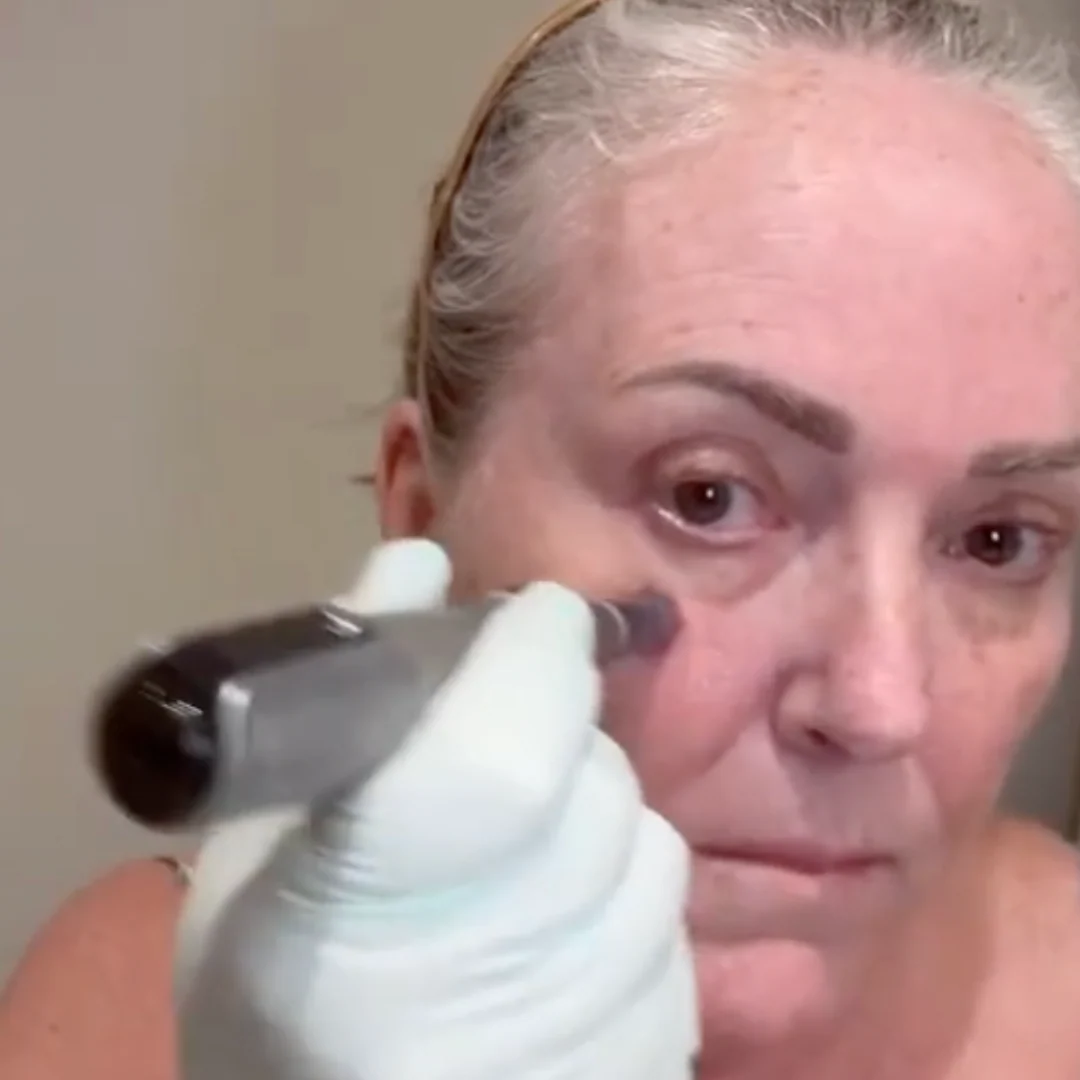 Dr. Pen M8S Microneedling Pen - Image 7