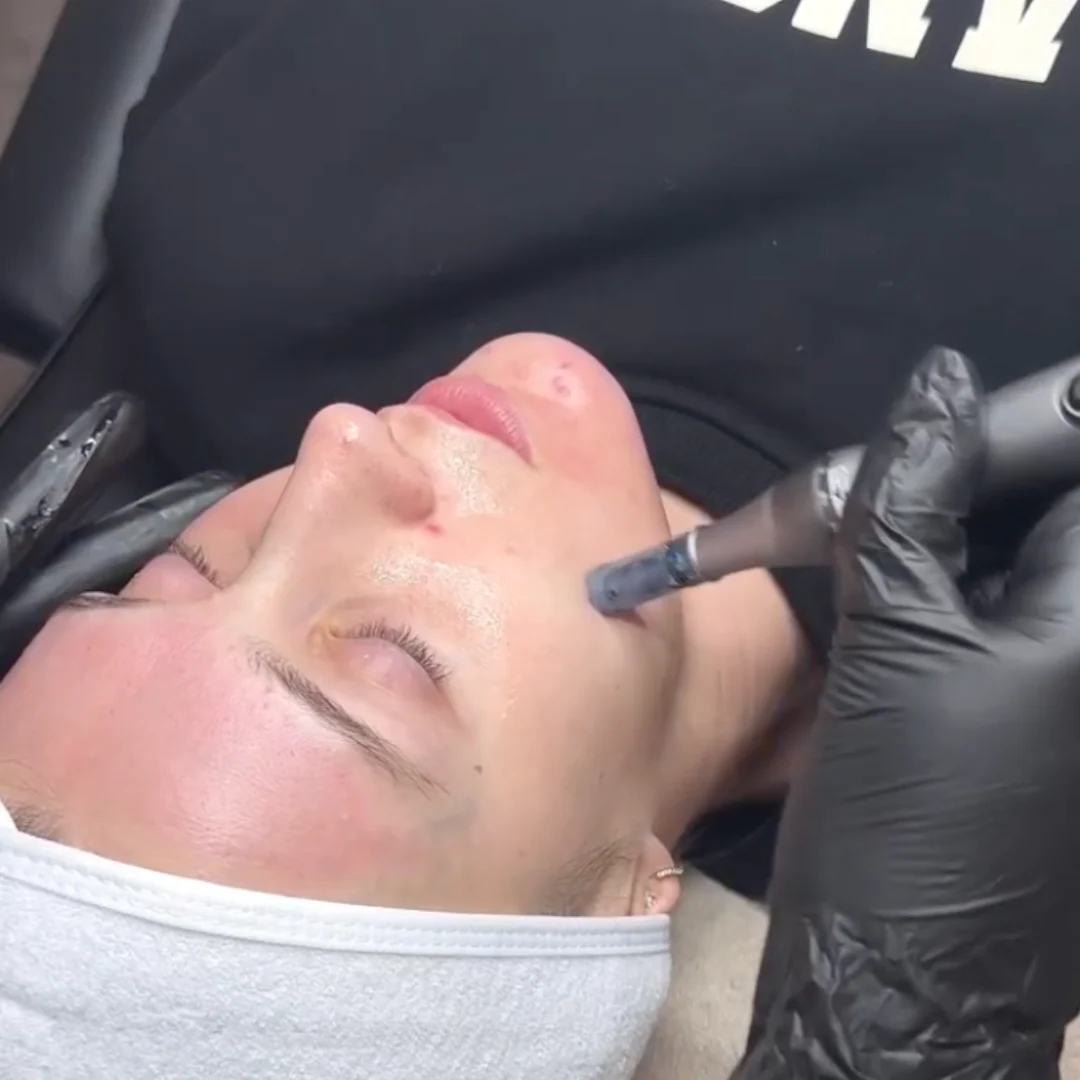 Dr. Pen M8S Microneedling Pen - Image 9