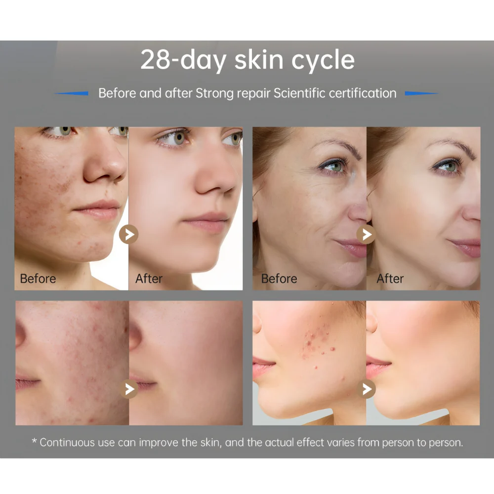 *NEW* Dr. Pen M9 Microneedling Pen - Image 5