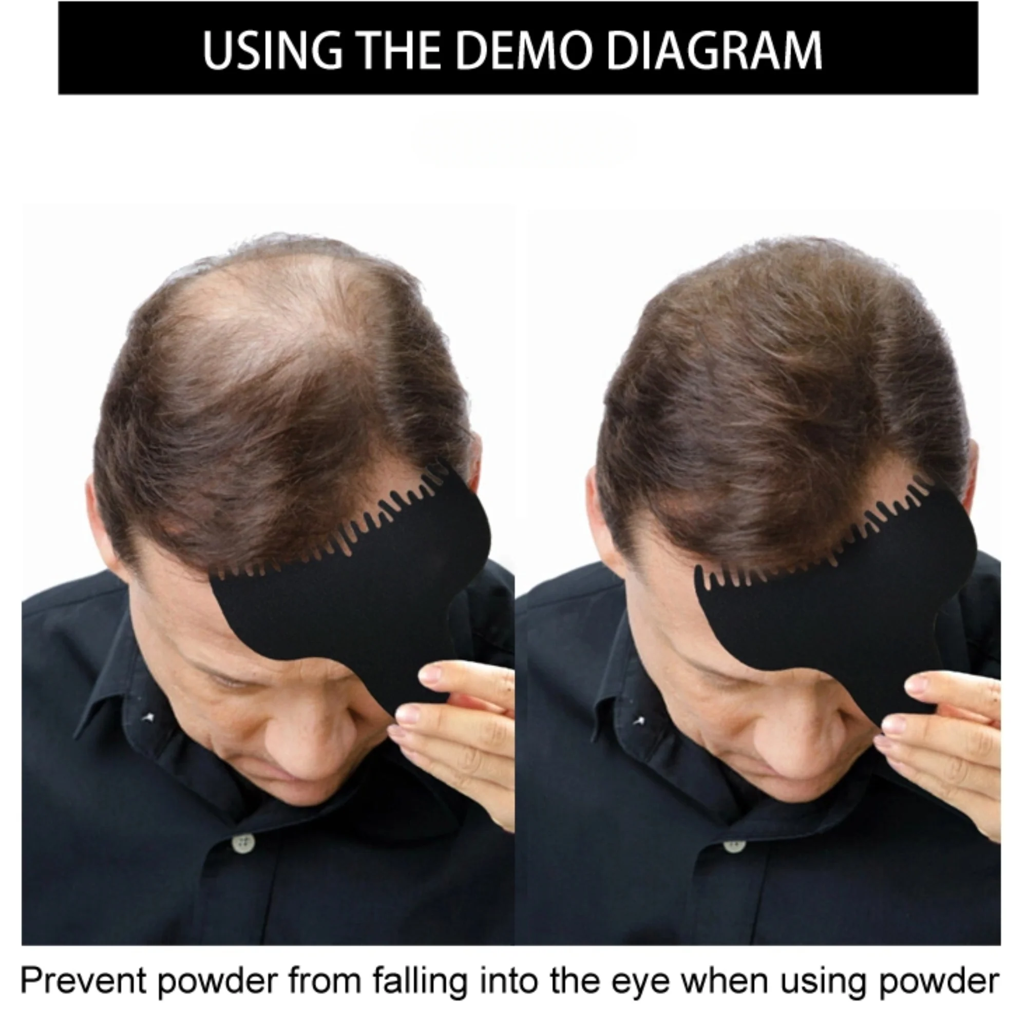 Hairline Optimizer - Image 3