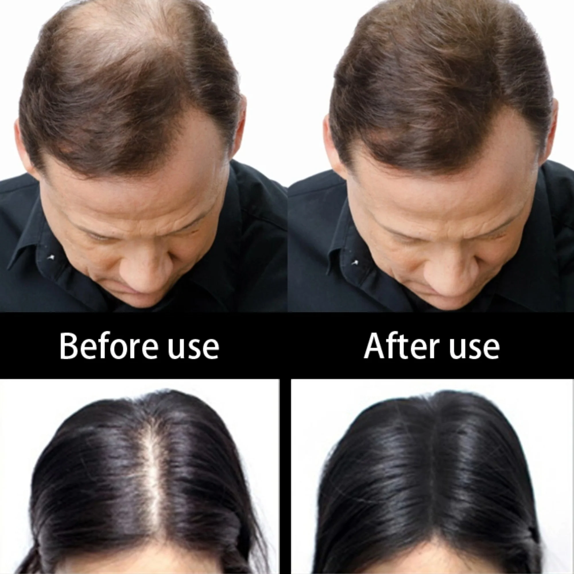 Hairline Optimizer - Image 4