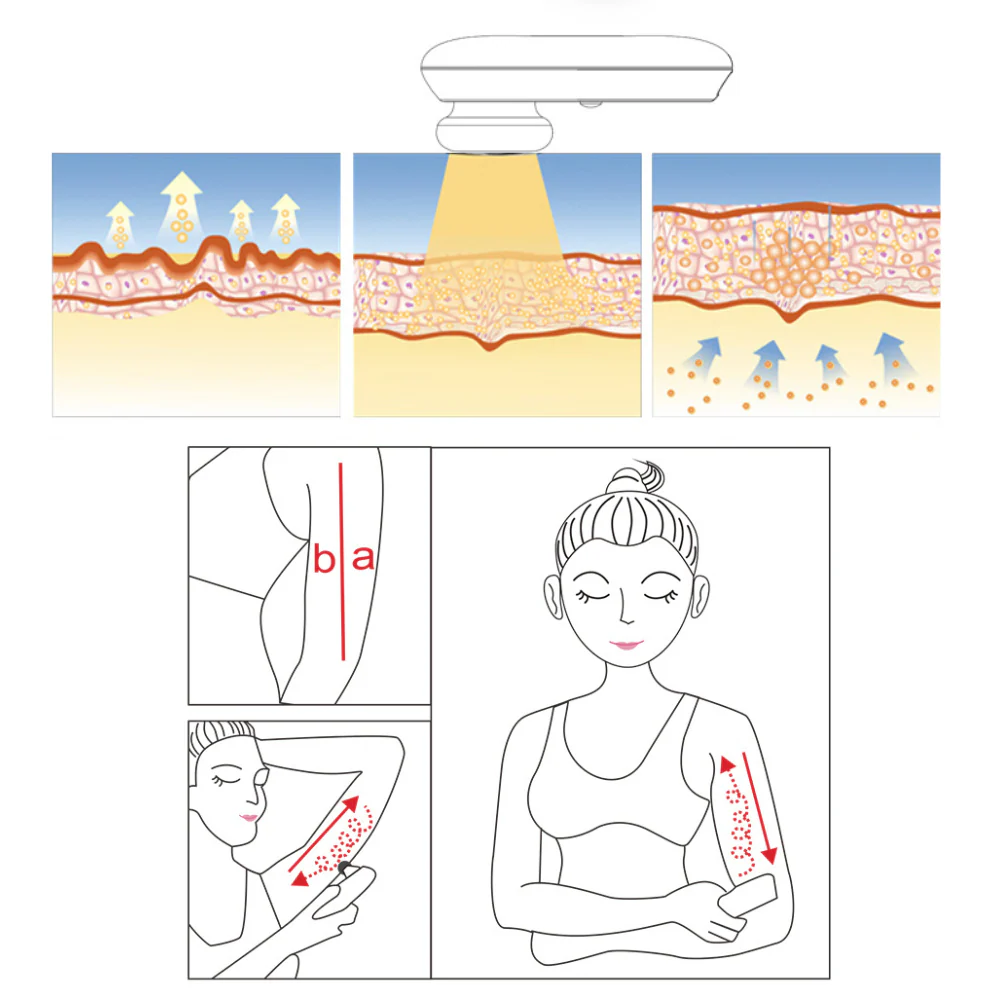 Peachaboo Face and Body Skin Tightening Radio Frequency Device - Image 4