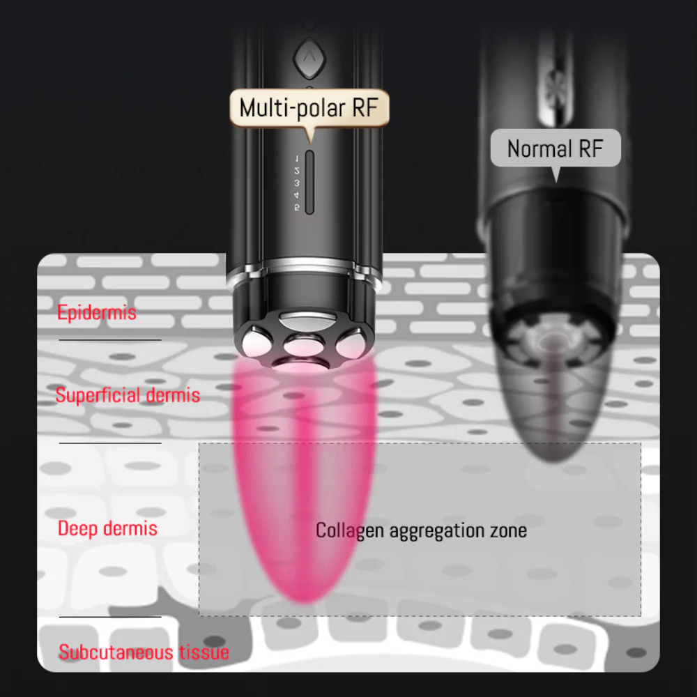 PRO Facial RF Skin Tightening Wand - Image 3