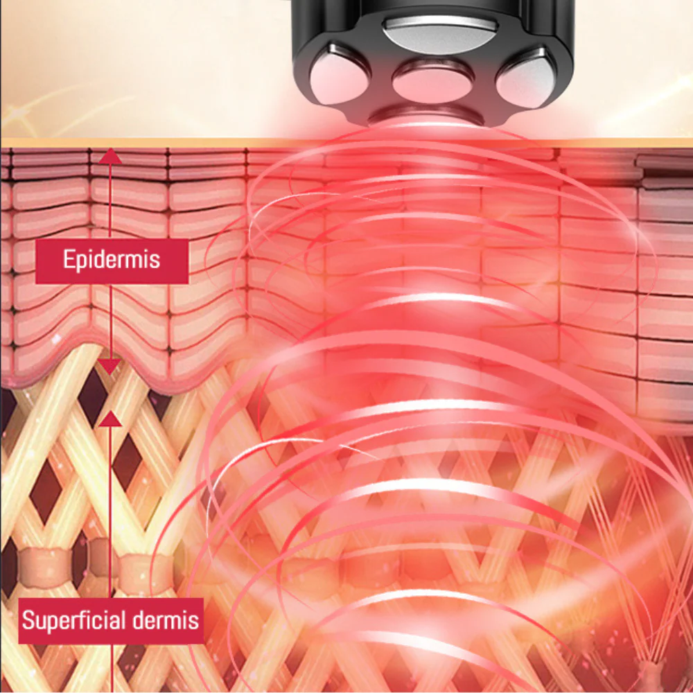 PRO Facial RF Skin Tightening Wand - Image 6