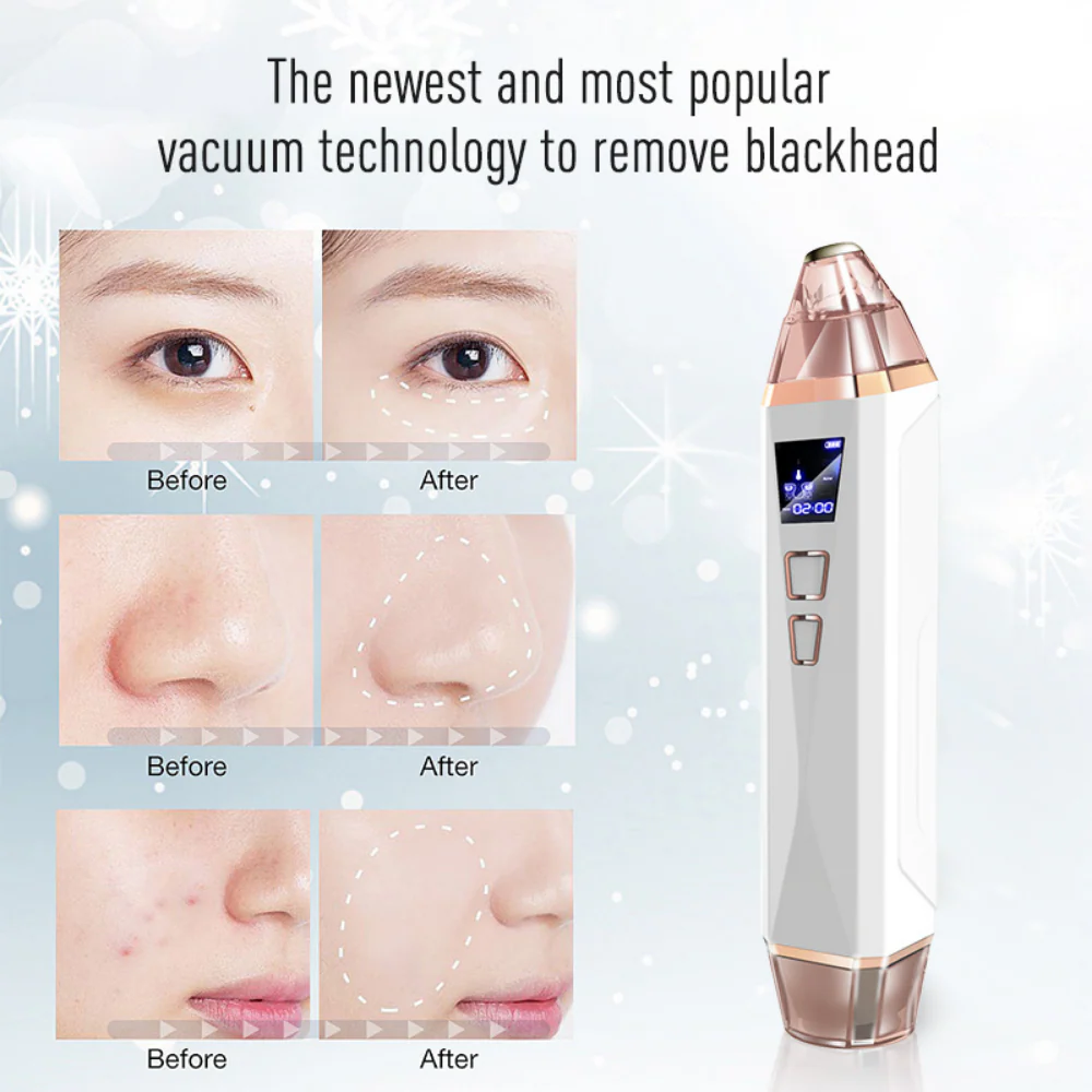Femvy Purifying Pore Vacuum - Image 9