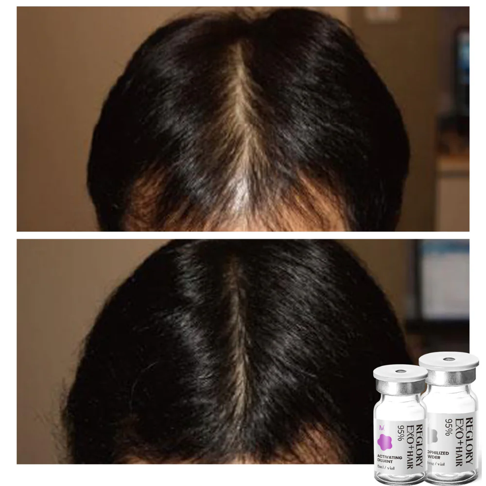 Reglory EXO⁺ Hair Growth Serum - Image 10