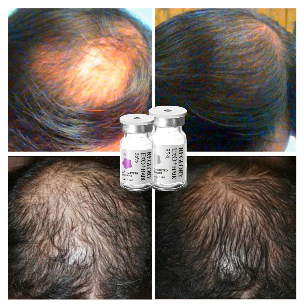 Reglory EXO⁺ Hair Growth Serum - Image 11
