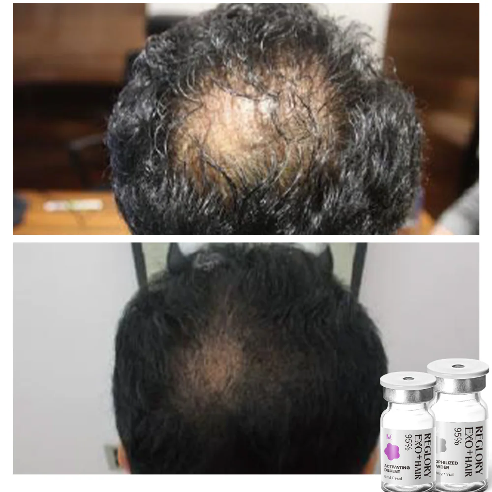 Reglory EXO⁺ Hair Growth Serum - Image 3