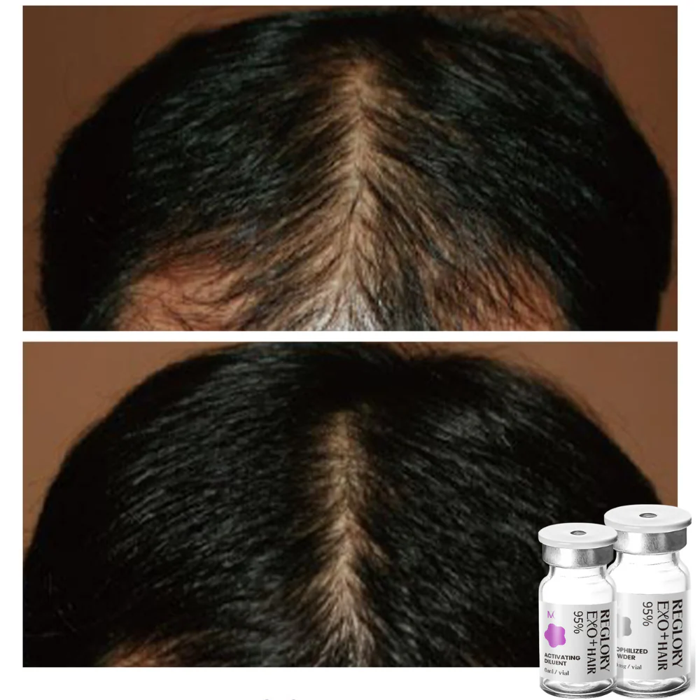 Reglory EXO⁺ Hair Growth Serum - Image 5