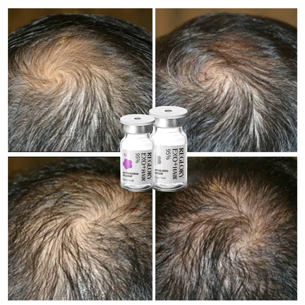 Reglory EXO⁺ Hair Growth Serum - Image 7