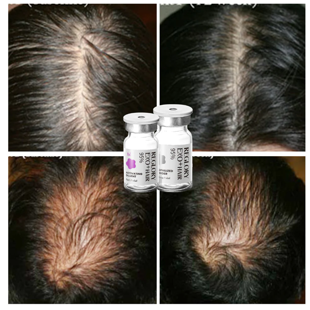 Reglory EXO⁺ Hair Growth Serum - Image 8