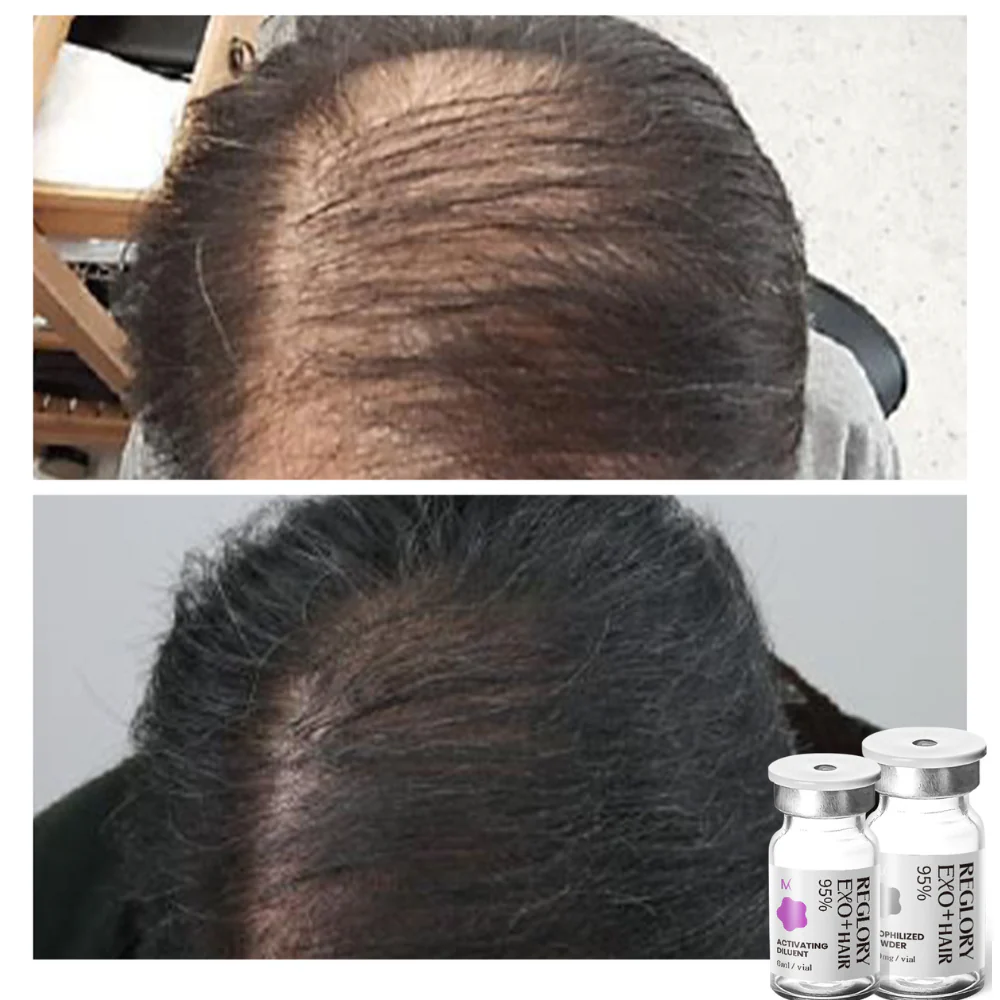 Reglory EXO⁺ Hair Growth Serum - Image 9