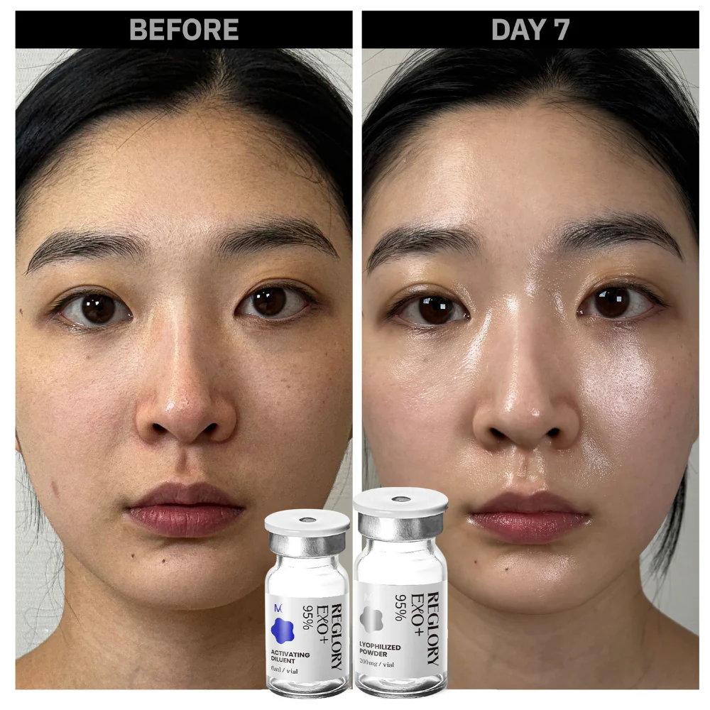 Reglory EXO Exosome Skin Booster - Image 3