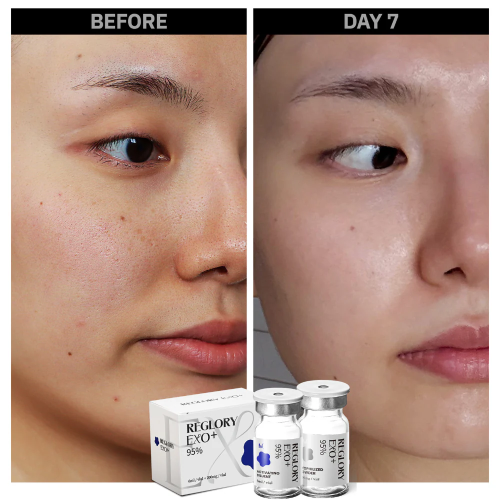 Reglory EXO Exosome Skin Booster - Image 4