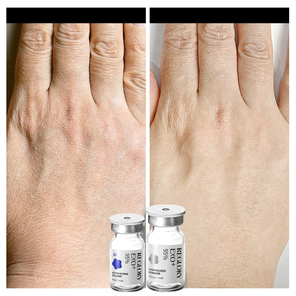 Reglory EXO Exosome Skin Booster - Image 5