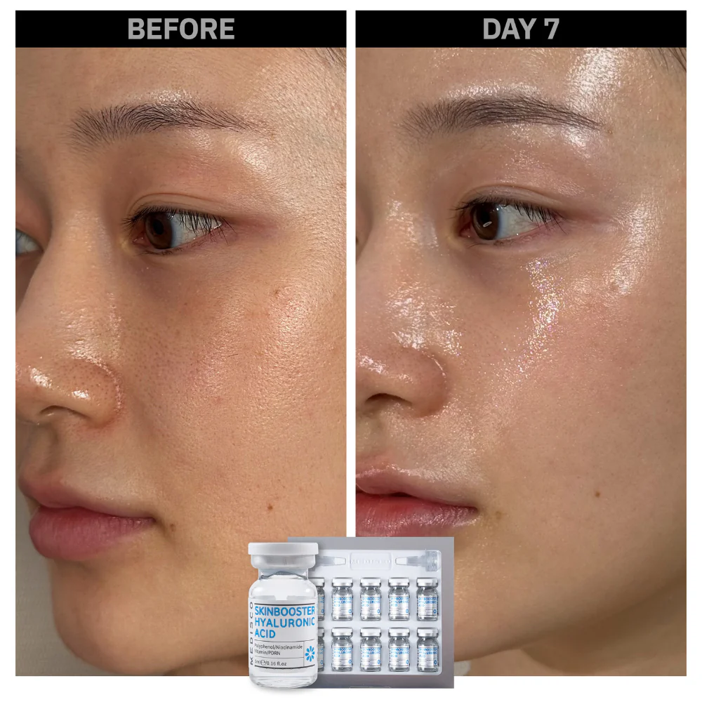 Stayve Booster Starter Kit 2 (Microneedling Ampoule) - Image 5