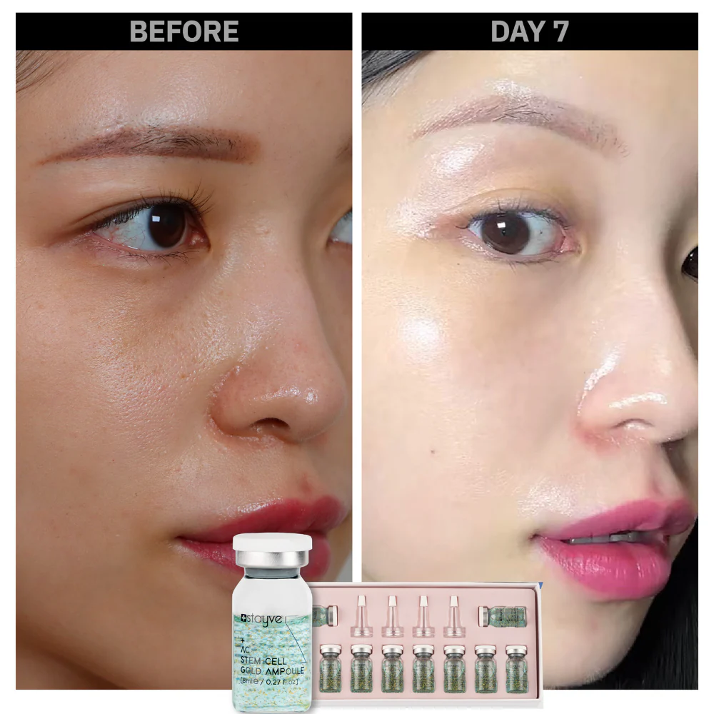 Stayve Booster Starter Kit (Microneedling Ampoule) - Image 10