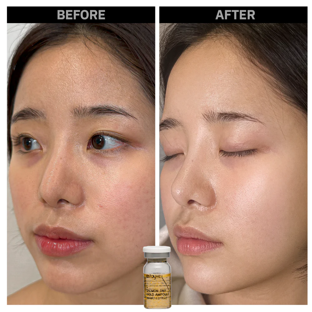 Stayve Booster Starter Kit (Microneedling Ampoule) - Image 4